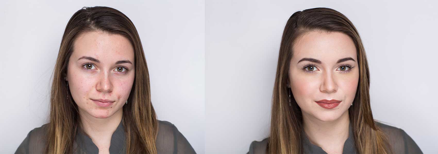 Beautiful woman before after face treatment